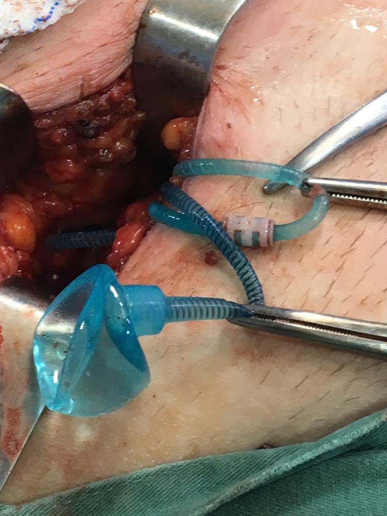 Marcelo Wroclawski tweet media