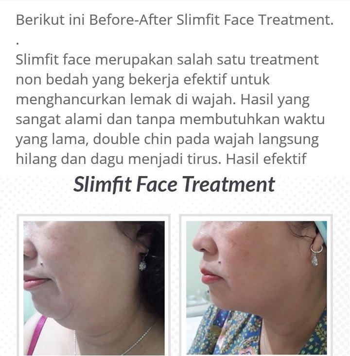 Impressions_'s tweet photo. Buat yang chubby atau sudah mulai kendur.. bisa coba ini. Hasilnya wow... https://t.co/44LAF0viKa