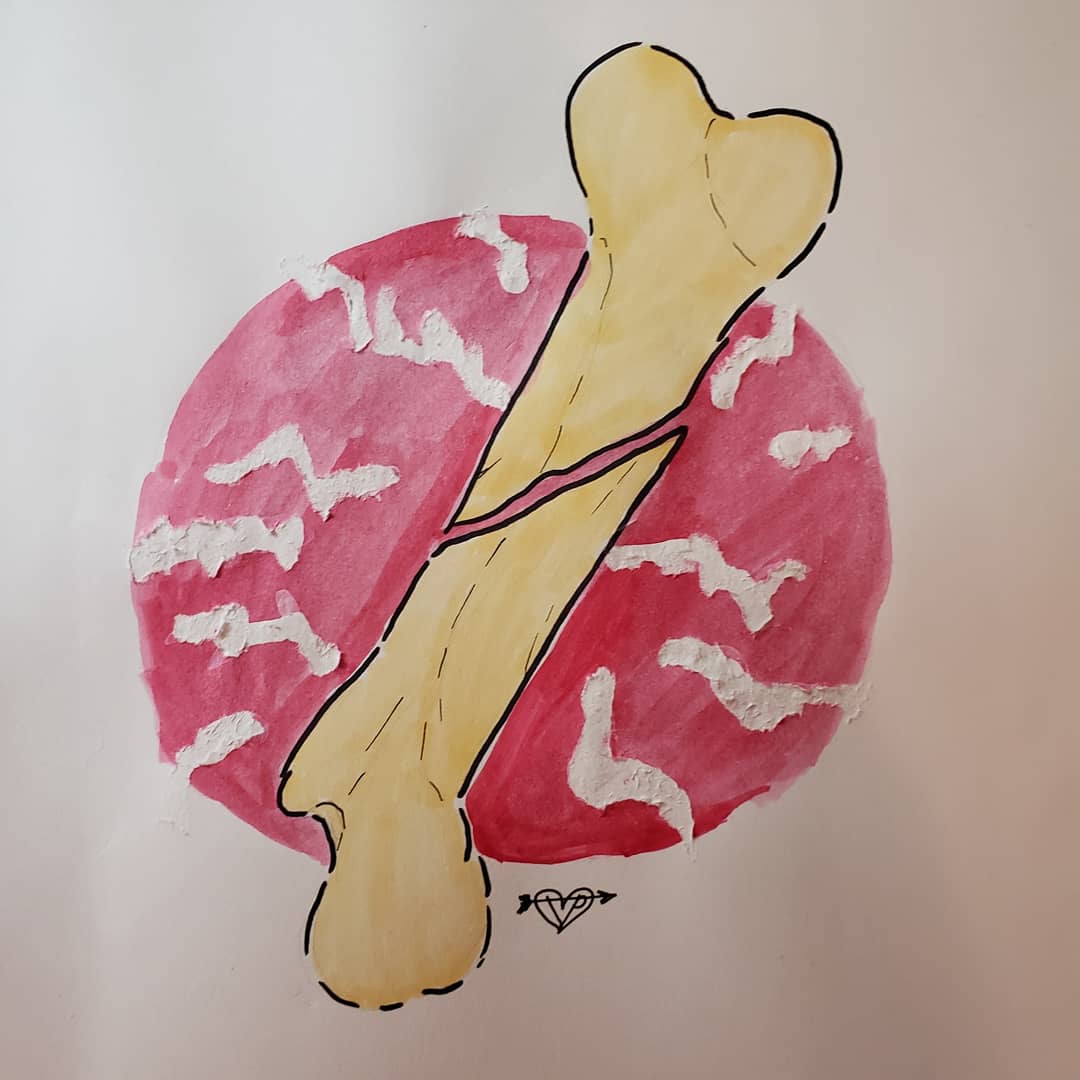 Tori_Peters_'s tweet photo. Inktober Day: 8
Prompt: Frail
Stick and stones and broken bones. (I tried to do something new with glue. It did go how I wanted it to but it still turned out interesting)
#inktober #inktober2019 #inktoberday8 #inktoberfrail #frailbones #ink #copicmarkers #copic https://t.co/tLfNF3Q1IB