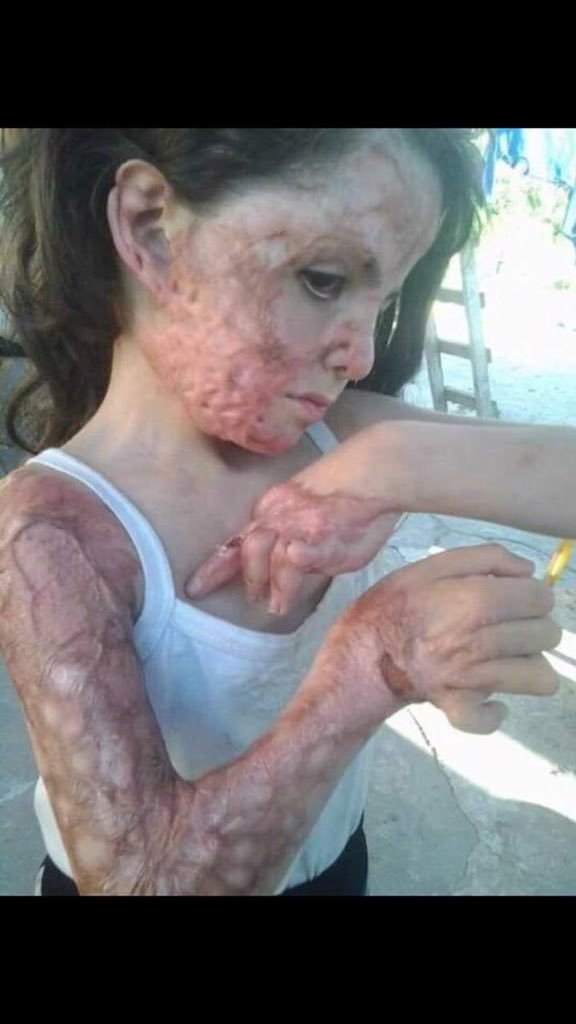 HolisticPsy1's tweet photo. @joncoopertweets @SJAC_info @OPCW @UN @UNGeneva @hrw @SavetheChildren @amnesty @IntlCrimCourt @congressorg #Assad2ICC
#ChemicalWeapons
#LockThemAllUp 

#MassSystematicAtrocities 
#GenocideToday https://t.co/wDPUvfH5ly