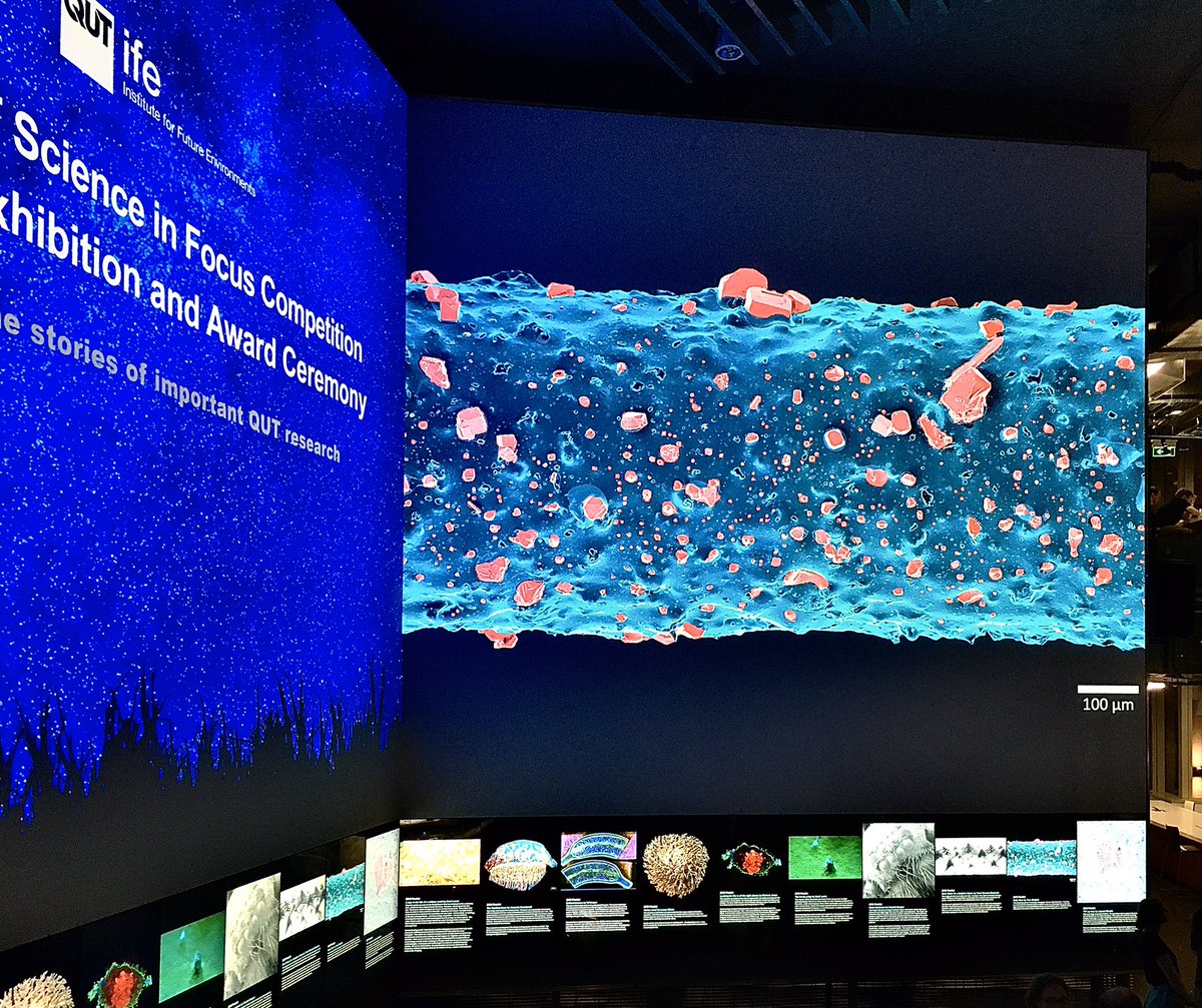 Excited to see my #microscopy image at the #ScienceInFocus Congrats to all the finalist and the winners 🥂 @IFE_QUT @QUTTheCube