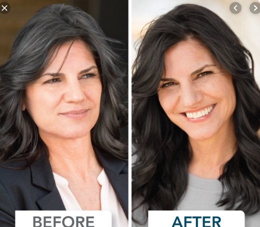 Prematuregraying Hashtag On Twitter