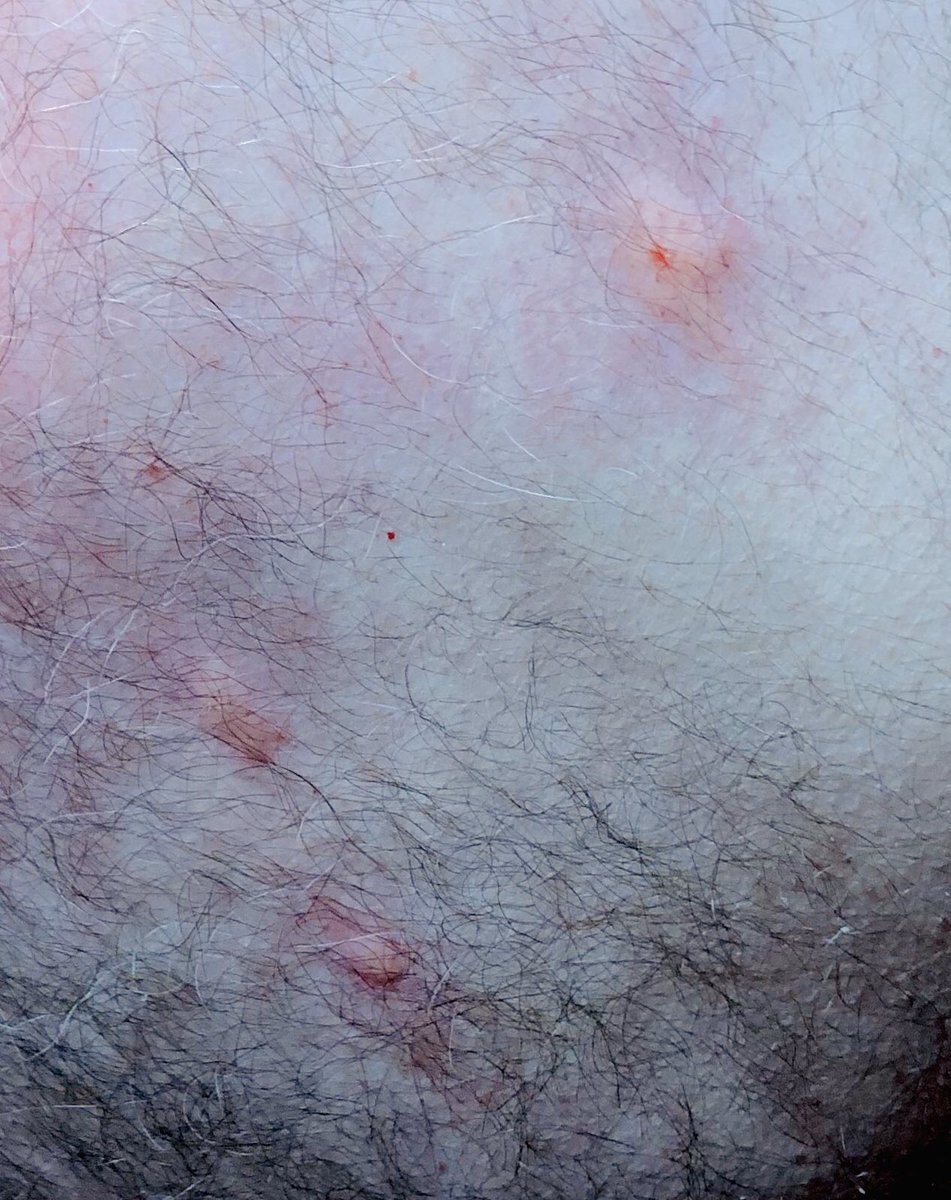 Misterquartet's tweet photo. #notabitofpluto #beastbites https://t.co/9ArDqCLuaM