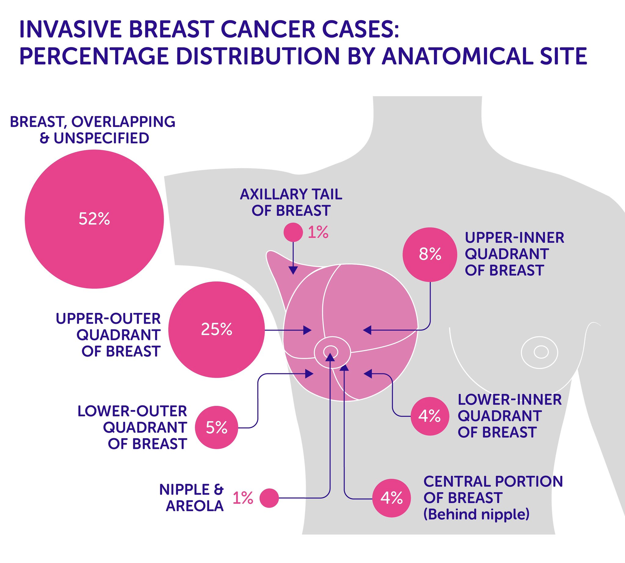 “Invasive #Breast #Cancer Cases: Percentage distribution by anatomical site...