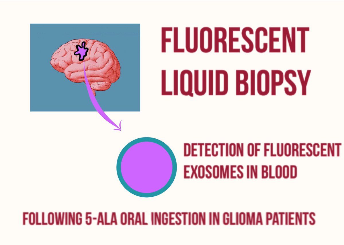 MGH Neurosurgery (@mghneurosurg) on Twitter photo Fluorescent liquid biopsy. A new concept from <a href="/MGHNeurosurg/">MGH Neurosurgery</a>. @PamelaSJonesMD <a href="/AnudeepYekula/">Anudeep Yekula</a> <a href="/BalajLeonora/">Leonora Balaj</a> <a href="/BobCarterMD/">Bob Carter MD PhD</a> See sciencedirect.com/science/articl… Fluorescent liquid biopsy. A new concept from <a href="/MGHNeurosurg/">MGH Neurosurgery</a>. @PamelaSJonesMD <a href="/AnudeepYekula/">Anudeep Yekula</a> <a href="/BalajLeonora/">Leonora Balaj</a> <a href="/BobCarterMD/">Bob Carter MD PhD</a> See sciencedirect.com/science/articl…