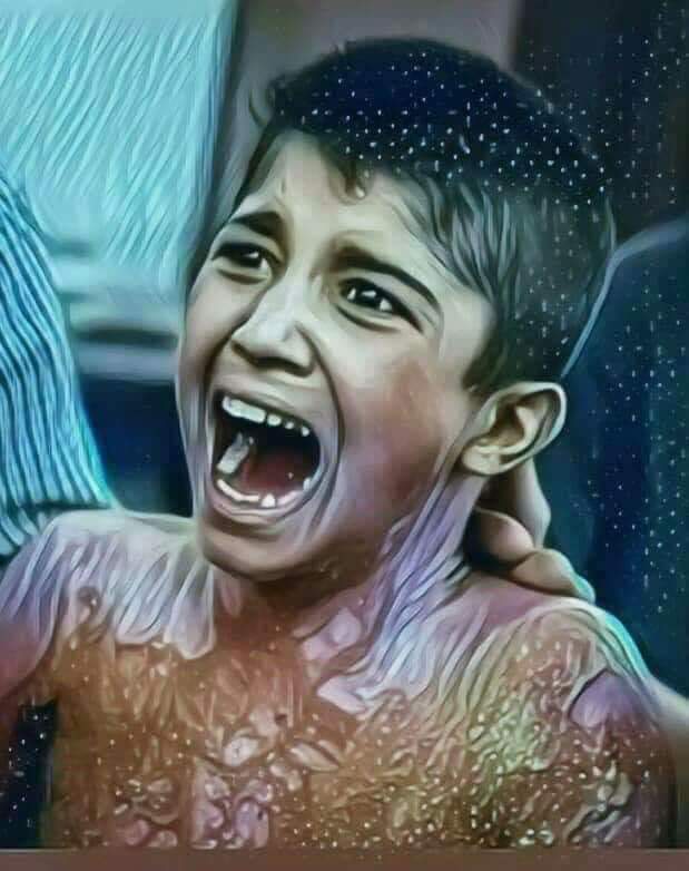 berzenci_ranya's tweet photo. #Phosphour_of_Turkey_Kills_Our_people
#فوسفور_تركيا_يقتل_شعبنا
#Fosfora_Turkiyê_gelê_me_dikuje https://t.co/q5ZUp6wRxl