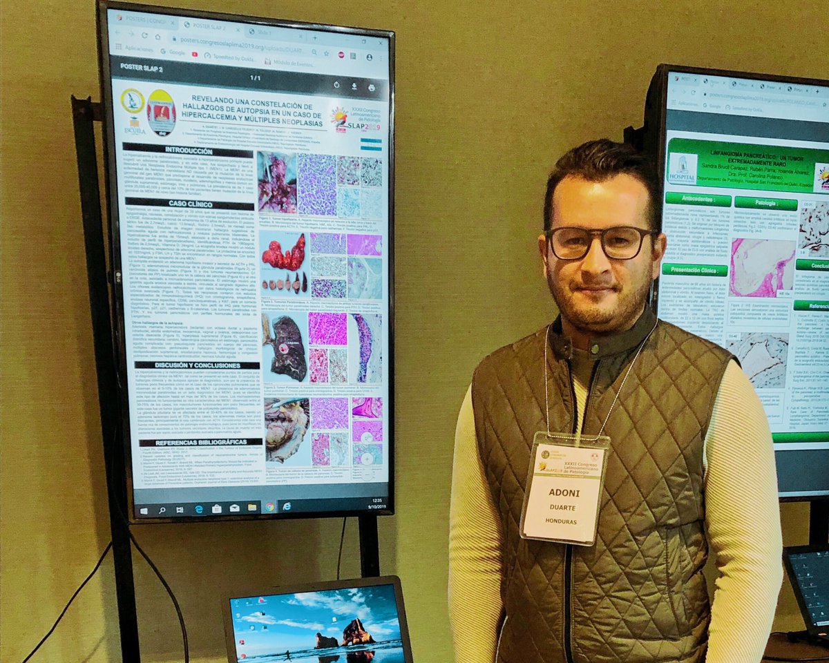 AdoniDuarte's tweet photo. #SLAP2019
Such a good memories from those days in Lima, Peru 🇵🇪
#pathology #pathologist https://t.co/3Jkt1JZgZR