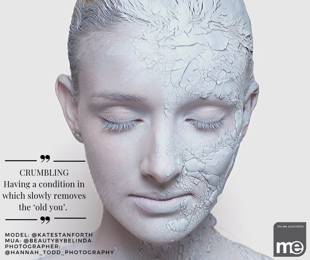 MEAssociation's tweet photo. 'Trapped. Masked. Crumbling.' 3 words Kate used to describe her Invisible Illnesses. What 3 words would you use to describe to describe you Invisible Illness?

#MakeMEVisible #MECFS #PWME #InvisibleIllnessAwarenessWeek https://t.co/2mFkPZec9O