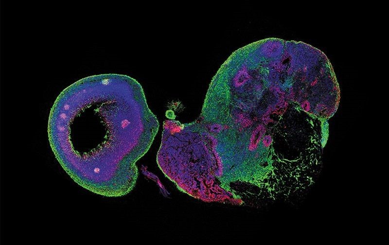 ScanBerlin's tweet photo. Meet the Organoids: Growing Human Brains in a Petri Dish https://t.co/v6l6jg37Sk https://t.co/FYToAlUiSZ