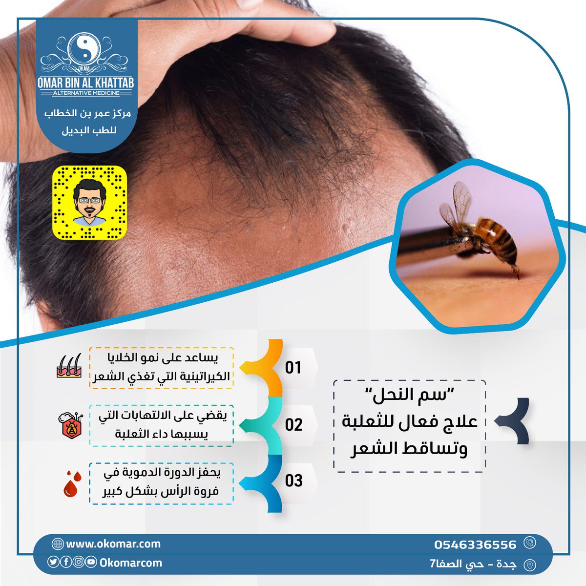 okomarcom's tweet image. #سم_النحل علاج فعَال في تنشيط الخلايا الكيراتينية في بصيلات الشعر

ماذا تنتظر ؟

احجز جلستك الآن .. مركز مرخص بكادر طبي متخصص وبخبرة أكثر من 15 سنة

نطبًق أفضل معايير السلامة ومكافحة العدوى 

#الثعلبة