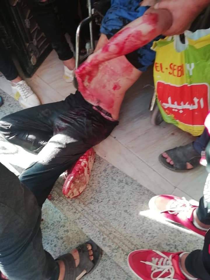 Wa7eed84397666's tweet photo. #حق_محمود_لازم_يرجع
قاضي السماء عاااادل
حكمتم بالعدل ام بسواه
فمردنا إلى الواحد القهار
وكل سينول جزائه
خير كان ام غير ذلك https://t.co/buU99rhRPf