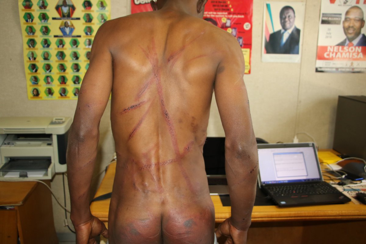 We all want a truly democratic #Zimbabwe where the State serves its citizens with honour and upholds all principles of #Constitutionalism, and where #Torture and #Abductions will never be used as a weapon of #suppression
#NoToHumanRightsAbuses