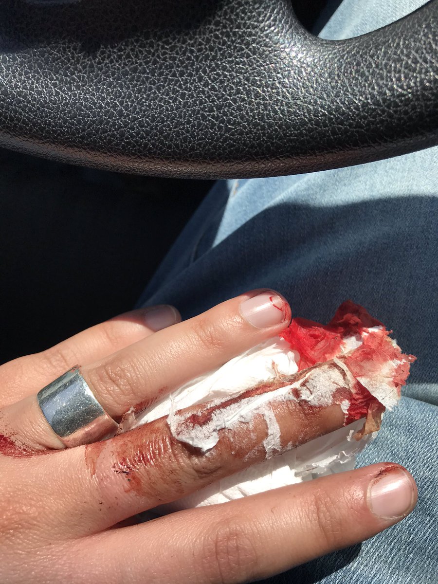 El_Relajadito's tweet photo. Fui a buscar una boletas al local de mi viejo, pillé a un flaite rompiendo lo poco que quedo. Le saque la CTM, si no llegan los pacos aún le estoy pegando al ctm. Lo malo es que me revente dos dedos 😒. Pero que rico fue pegaré al CTM 👊🏼 https://t.co/7JgO48HuzG