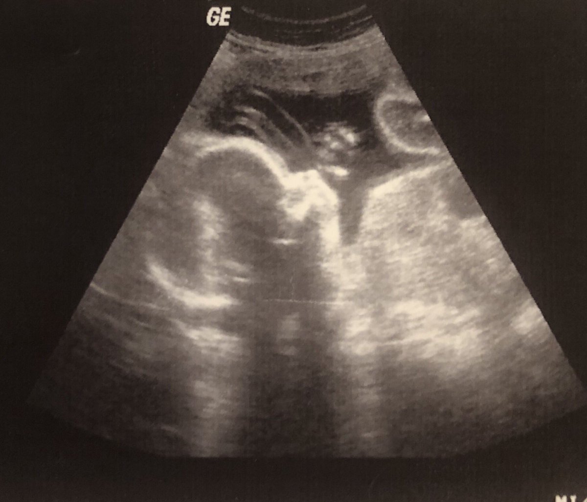 15YearOldSteve's tweet image. #SendBackSunday