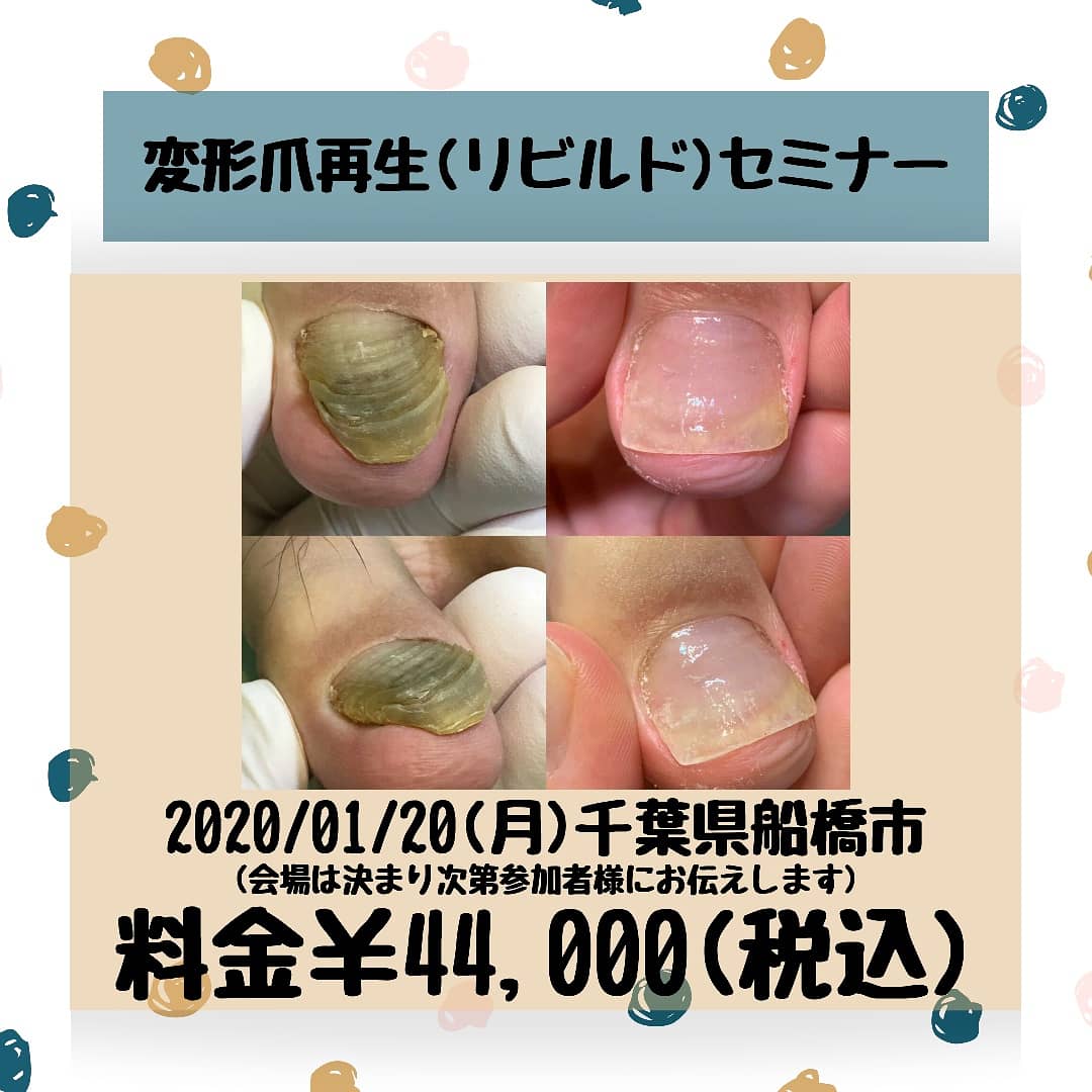 男爪 男爪
