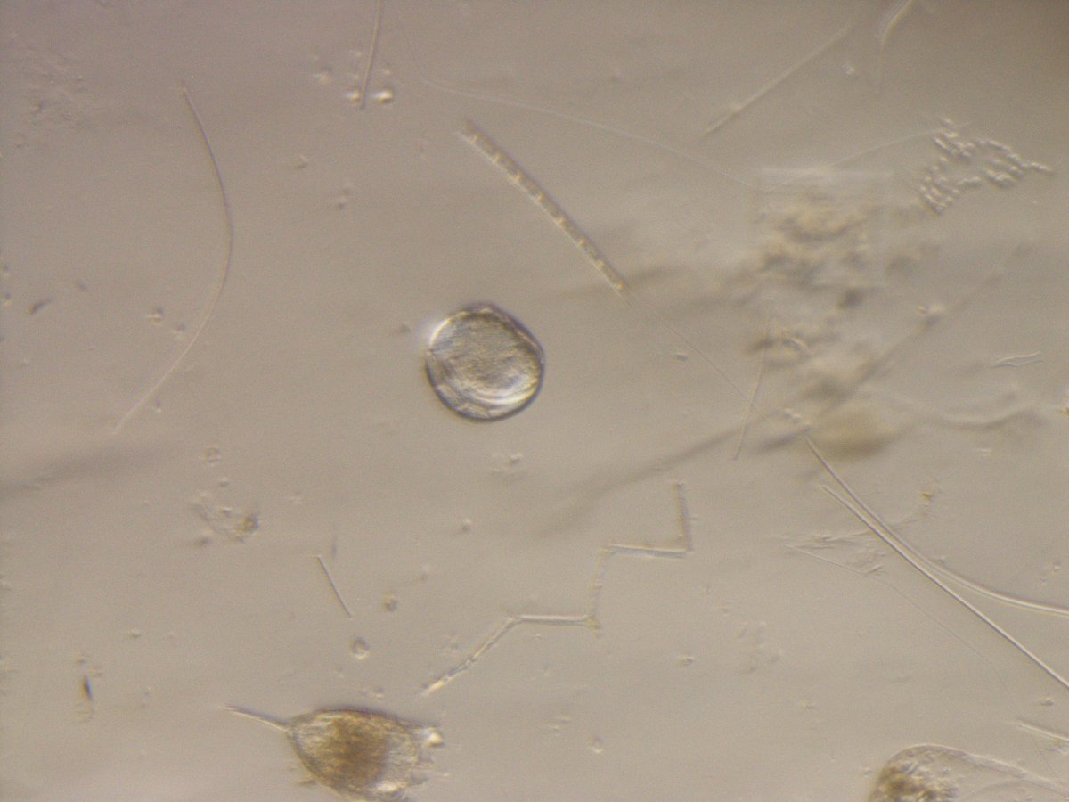 #NewsRelease Water sample reveals zebra mussel larvae in Ten Mile Lake in Cass County go.usa.gov/xpCeA