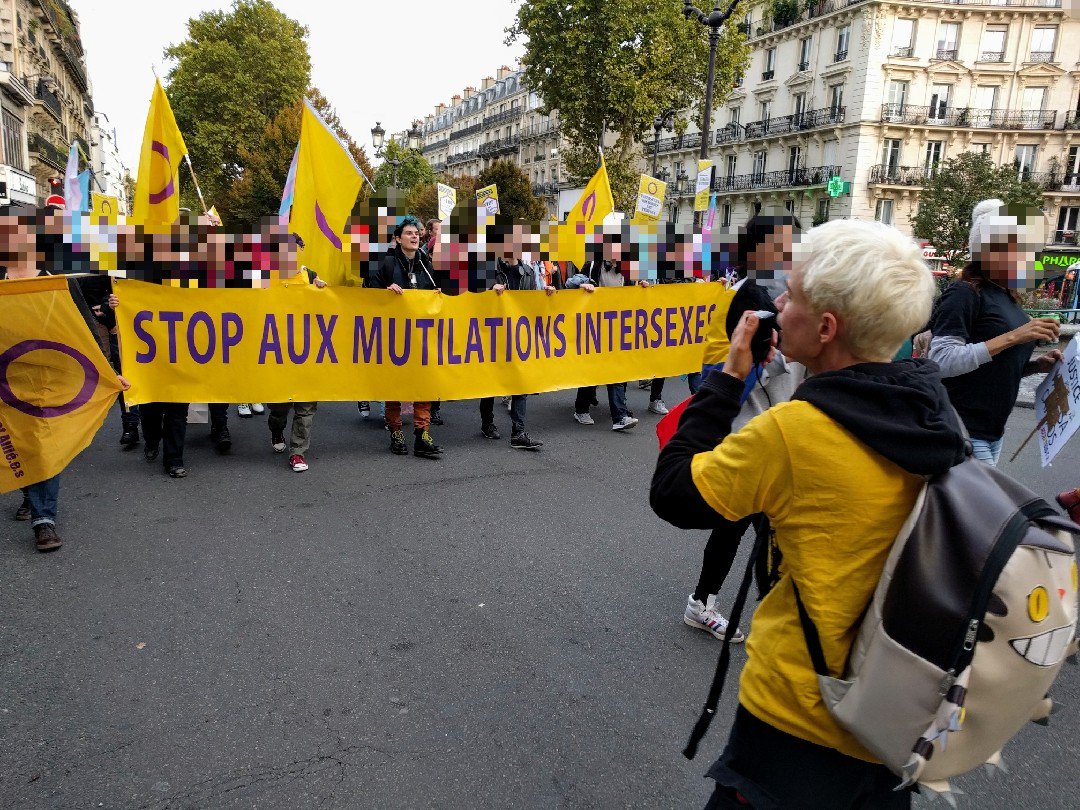 Fourmidable__'s tweet image. J&apos;ai pris un paquet de photos à l&apos;#existransinter mais je pense que celle là c&apos;est ma préférée

J&apos;ai flouté tout le monde dans le doute, sauf @Petit_Aidenix et @tourbillonfou qui avaient demandé des photos d&apos;eux

#intersexrights #stopmutilationintersexe