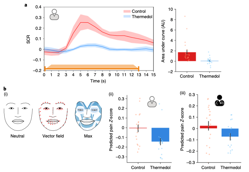 Proud to share our new work on socially transmitted placebos with a strong team effort by  <a href="/elvandy1515/">Pin-Hao Andy Chen</a> <a href="/jcheong0428/">Jin Hyun Cheong</a> <a href="/Eshjolly/">Eshin Jolly</a> <a href="/hirshelhence/">Hirsh Elhence</a> <a href="/torwager/">tor wager</a> published in <a href="/NatureHumBehav/">Nature Human Behaviour</a>  nature.com/articles/s4156…