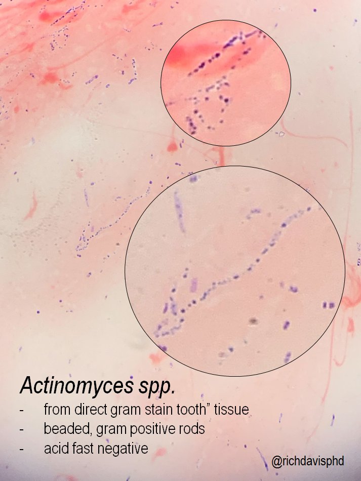 Gram Positive Rods
