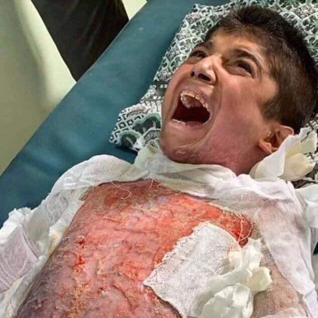 “Crees que quemándome y bailando sobre mis cenizas, eliminarás mi identidad?
Crees que acabarás con mi historia y mi nombre?
Volveré y haré de ti el diablo. 
Volveré...”. 
Niños quemados por un miembro de la #OTAN #SaveRojava #TerroristTurkey