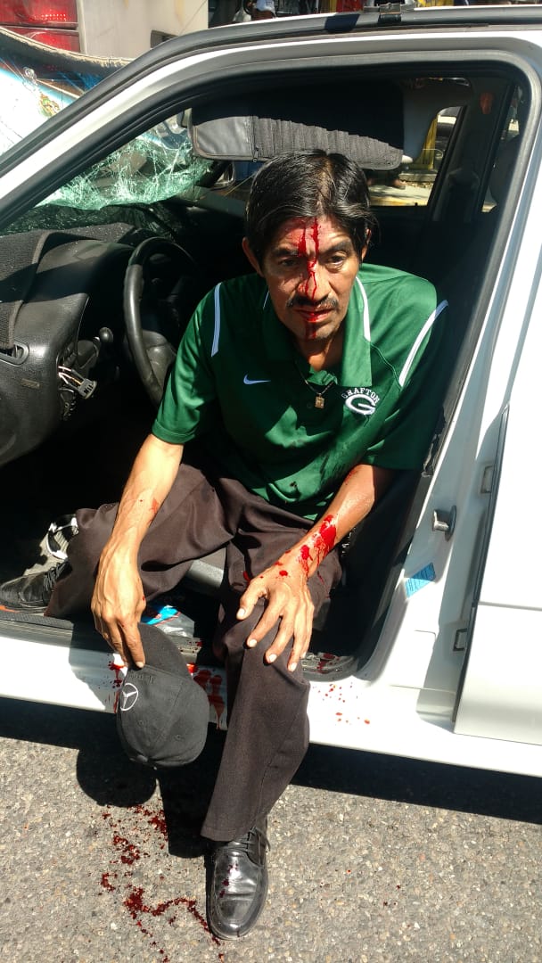 AgenciaSpiaboc's tweet image. #Alerta @Oaxaca_9_1_1 fuerte choque en Santa Rosa a la altora del Pitico una persona lesionada se requiere también a #Pvml de @MunicipioOaxaca con información de @florydiazinfo vía #GrupoDeWatsApp @AconReg