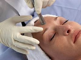 Infusion_Spa's tweet photo. We specialize in #DermaSweep MD! In one treatment your skin will feel softer, smoother and healthier. Get our Epi-Fusion treatment for just $150. Reference code DS1021 Call 650-471-9500 https://t.co/zwISPPGD2k