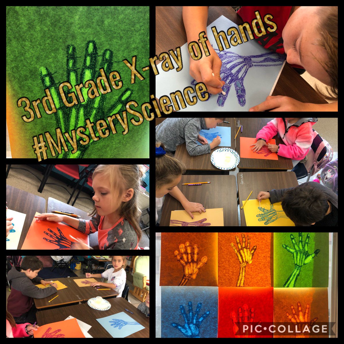 Learning about bones in our hands!  #MysteryScience 3rd grade #BostianElementary