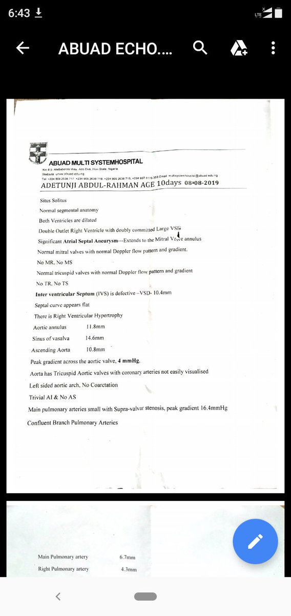 K_Basharr's tweet image. Good morning Nigerians. This is a call from a brother whose son, Adeniran Abdurrahman has been diagnosed with a cyanotic congenital heart disease (pentalogy of Fallot) just 2 months after birth.
The child needs a sum of N2.25m for a open heart surgery. Any amount will do.