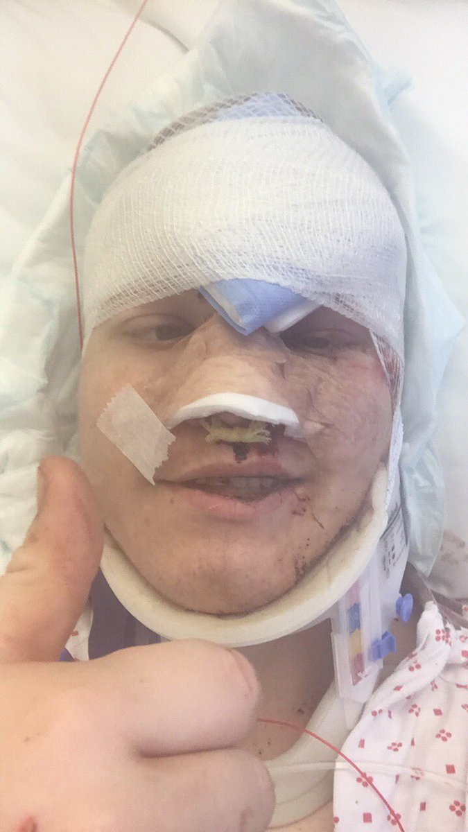 RunMahBlock's tweet image. I was in quite the bike accident the other day. But you’re videos @TeosGame has helped me keep busy and stay positive.  Thanks bud :)