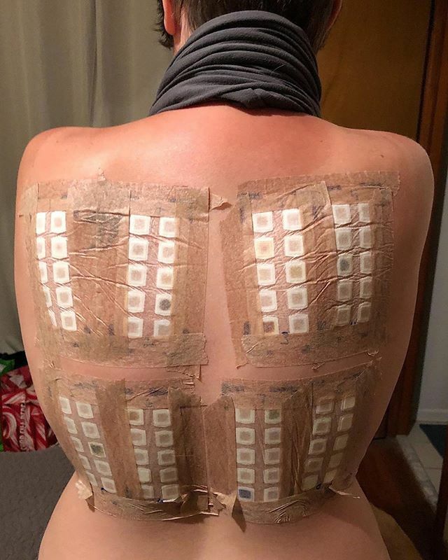 HonestOctober's tweet image. From @caro_bear
・・・
The older I get, the more things I seem to be allergic to. This year really stepped it up with eyelid hives (yep, that’s a thing) so I’m biting the bullet and taking steps to figure out all the things out to get me. This is a patc… ift.tt/2pKMJSI