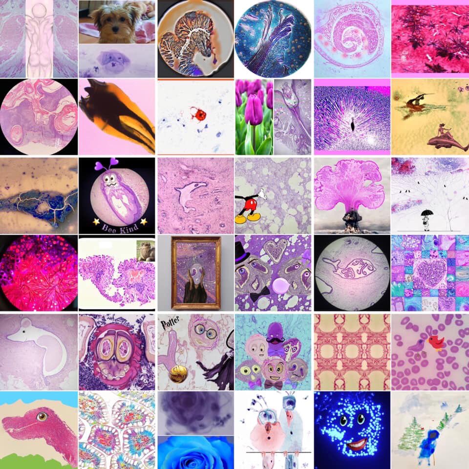 The day has come! Here are the winners of IIIrd International PathArt Photomicrography Contest! Congrats to all the winners! 👏🏻 
Please click on the link to see the winners and the photos of all the contestants: turkjpath.org/contest_2019.p…

<a href="/pembeoltulu/">Pembe Oltulu, MD</a> @sultan_clskn_dr <a href="/OlgerHatice/">Hatice Olger Uzuner,MD</a>
