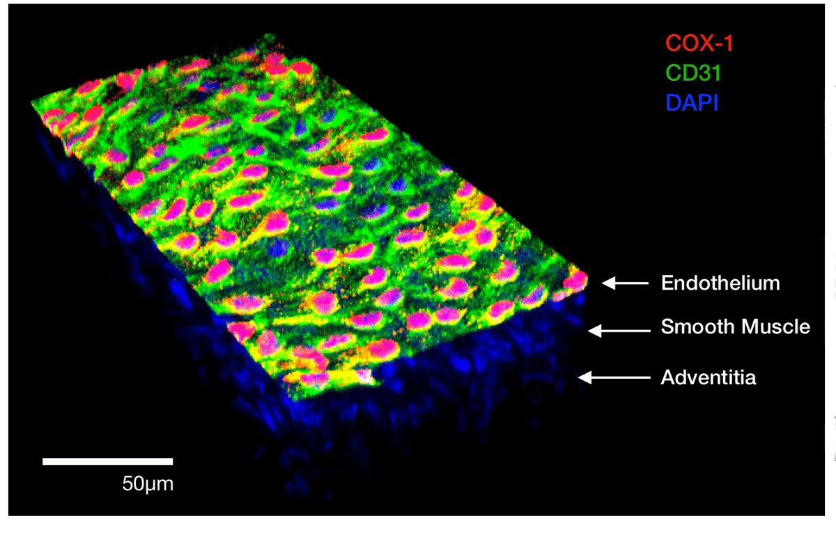 CircRes's tweet photo. #Endothelial vs. #platelet COX1: solving an old paradox and defining a new paradigm!
A study from @imperialcollege shows that, endothelial #COX1 provides an essential anti-#thrombotic tone. https://t.co/UYKoaq8n33 https://t.co/JNLMwtYXmu