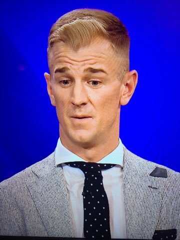 Joe Hart has turned up at the BT Sport studio doing an impersonation of Stan Laurel.