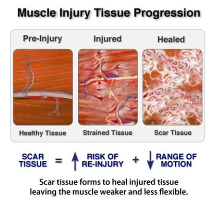 #Chiropractic care speeds up recovery and decreases pain quickly. Give us a call for a consultation or to find out more (914) 961-7575.