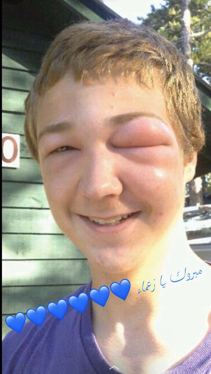 #الهلال_السد_دوري_اسيا