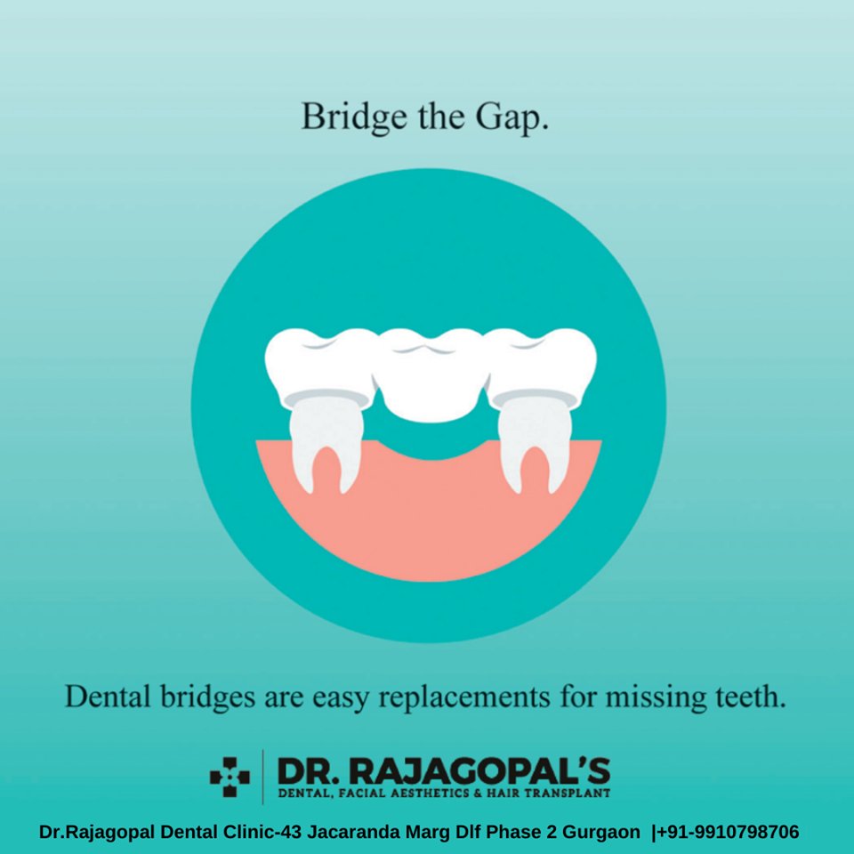 mohitku52234585's tweet image. Avoid the Ache. Call About a Checkup Today.
Let Us Be a Part of Your Smile !
👉Visit Dr. RajaGopal's Dental Clinic
Call: 📲9899057337, 9958960621
Visit 🌐 drrajagopals.com/child-dentist-…
#RCT #Rootcaneltreatment #teethcap #drrajagopal #DelhiNcr 
#Gurgaon #dentalcare #Dental