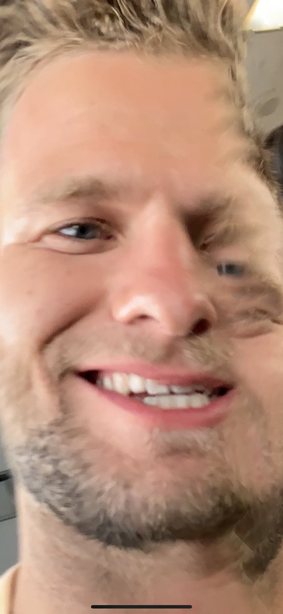 Jacob Sharpe had brain cancer 😏 tweet media