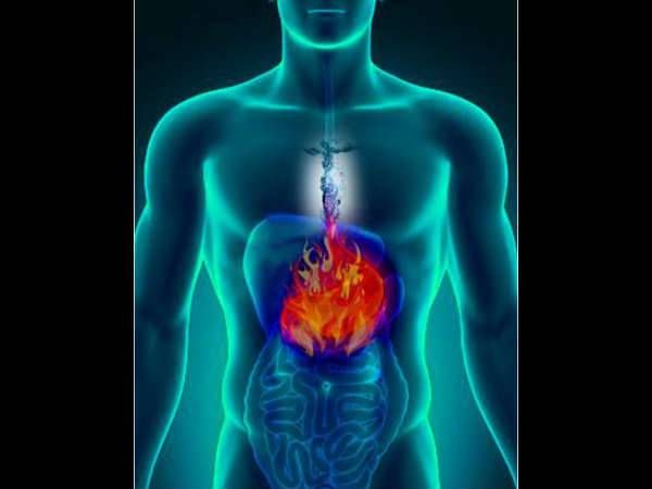 Letsdiskuss's tweet image. The causes of acidity are…
 #CausesofAcidity #Healthtips #Acidityreason #HealthyLiving
buff.ly/2Jd5xAO