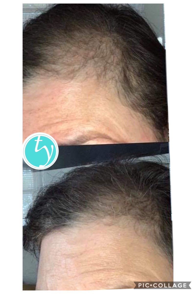 True You Skin (@trueyouskin) on Twitter photo 