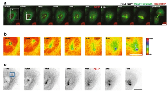 BMCBiology's tweet image. In case you missed it: Two-step #interphase #microtubule disassembly aids #spindle #morphogenesis

@BaumBuzz and colleagues highlight the importance of the step-wise remodelling and #permeabilisation in cells for mitotic entry

bit.ly/2DCIHkh