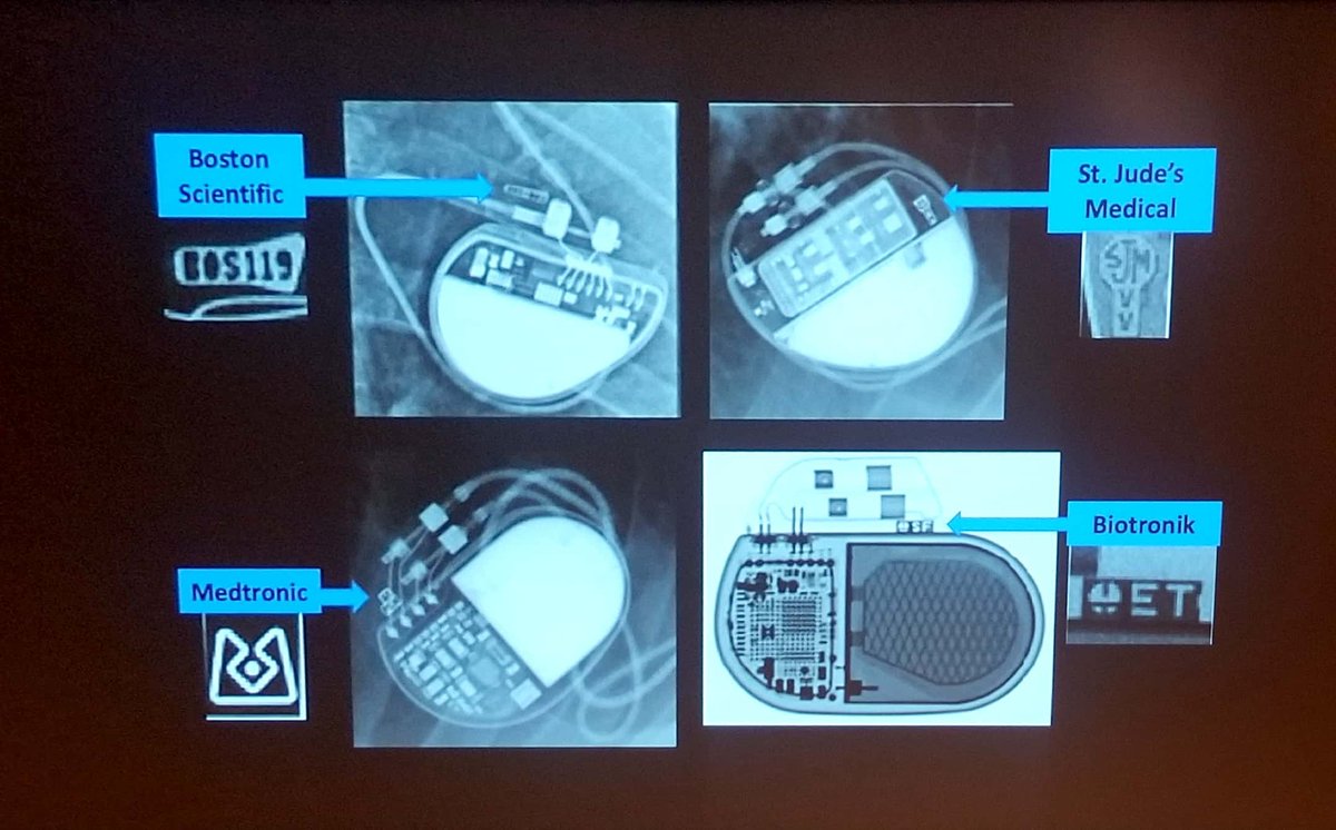 Dr. Ng from @Core_EM at @AllNYCEM on AICDs:
⚡Pts w/AICD have already died or at risk for dying so...Respect the AICD 
⚡Get pads on early if it has fired multiple times as battery can drain quickly
⚡Use the algorithm + picture below for identification & work up
#FOAMed #emconf