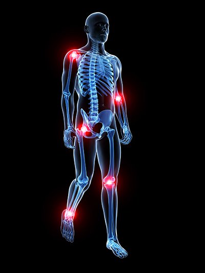 Free Second Opinion for Joint Pain Sufferers tinyurl.com/y6a27u3b #ChronicJointPainNYC #NYCJointPainSpecialist