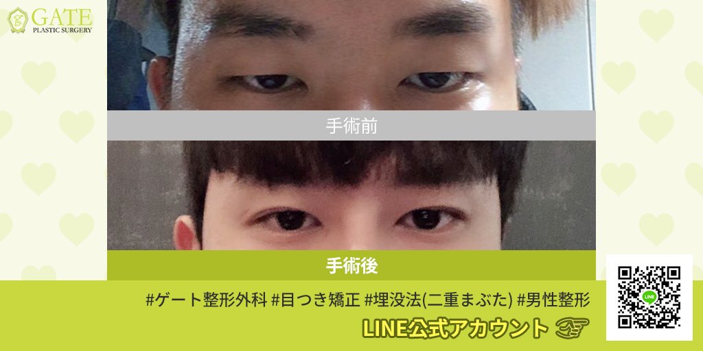 男性整形 Twitter Search Twitter