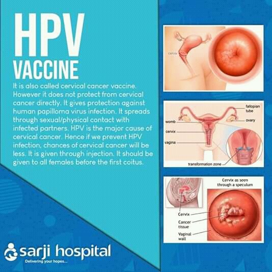 WagioJoyce's tweet photo. Government should educate people about HPV Vaccine,like in my slum no one has heard about it. https://t.co/I2rvBdD6gd