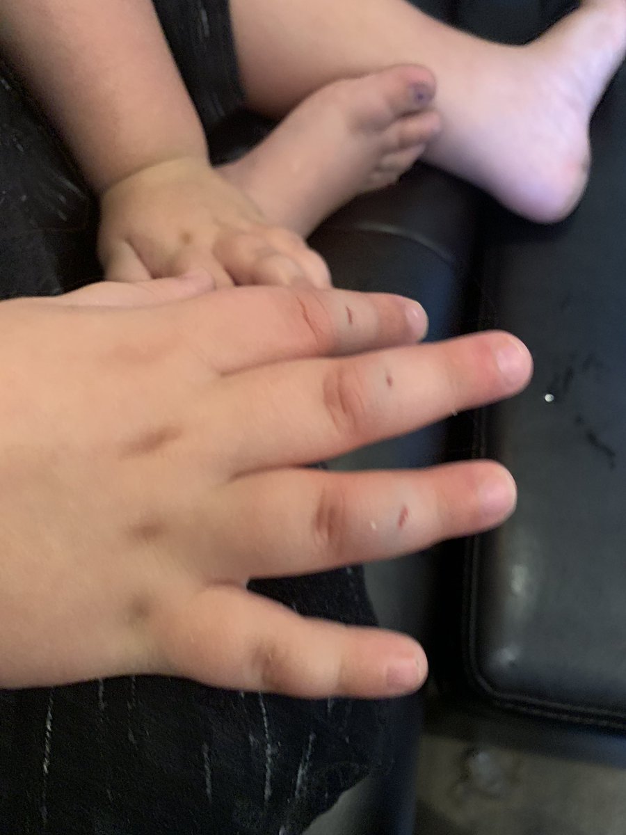 theemisunshine's tweet photo. Bus door for the win... #tateisatrooper #accident #poorlilguy #feelingwellenoughtofistbump https://t.co/iqRwDgkMn4