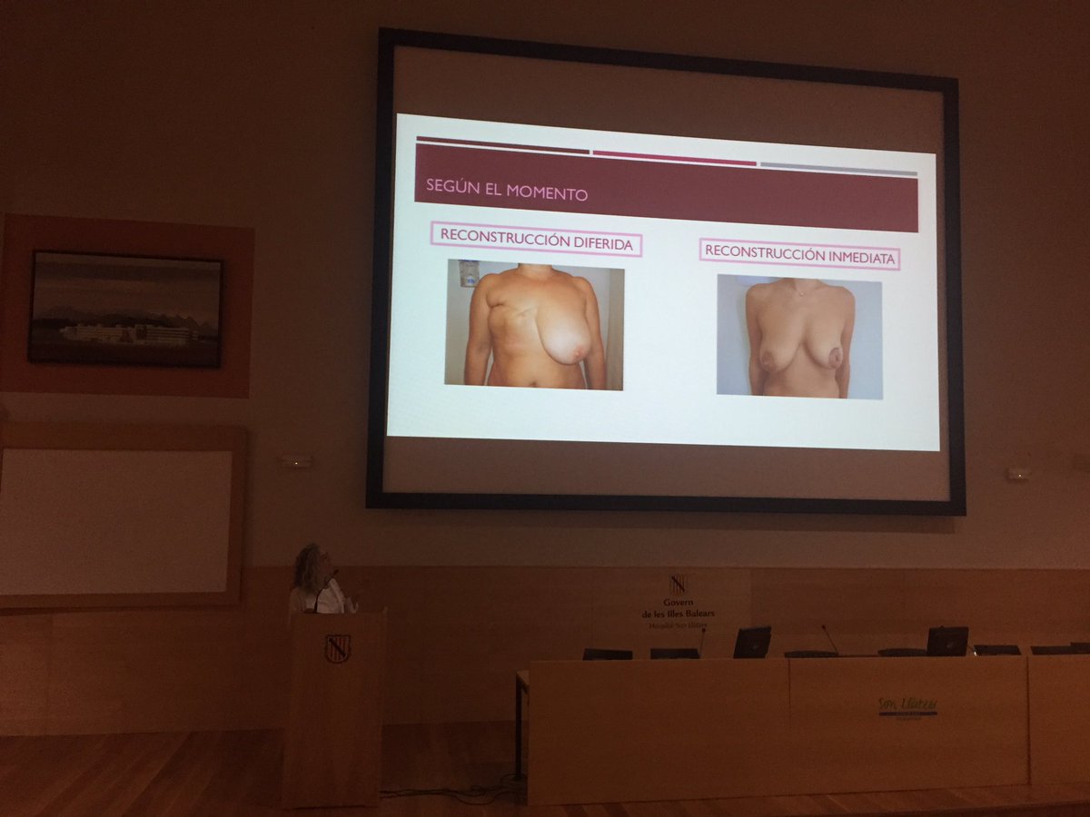 Cirurgia Son Llàtzer (@cirugia_hsll) on Twitter photo Técnicas de reconstrucción tras cirugía oncológica de mama y resultados de nuestro estudio de satisfacción de las pacientes. Las Dras Emma Torres y Mar Escales <a href="/Miamaar/">Mar Escales Oliver</a> en la sesión general de <a href="/SonLlatzer/">Hospital Universitari Son Llàtzer</a>. Preparadas para presentarlo en <a href="/RNCsantander/">Dieter Morales #yosoydelclinico</a> 💪🏼 Técnicas de reconstrucción tras cirugía oncológica de mama y resultados de nuestro estudio de satisfacción de las pacientes. Las Dras Emma Torres y Mar Escales <a href="/Miamaar/">Mar Escales Oliver</a> en la sesión general de <a href="/SonLlatzer/">Hospital Universitari Son Llàtzer</a>. Preparadas para presentarlo en <a href="/RNCsantander/">Dieter Morales #yosoydelclinico</a> 💪🏼