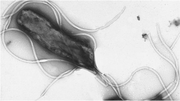 SerconLimited's tweet photo. #InterestingStudy The Bacteria That Cause Stomach Ulcers Are Becoming Drug-Resistant, Too
https://t.co/n1UhQ8LOx7
#ABCA2 #UreaBreathTest #Hpylori #HelicobacterPylori #UBT https://t.co/FxqS22waxe