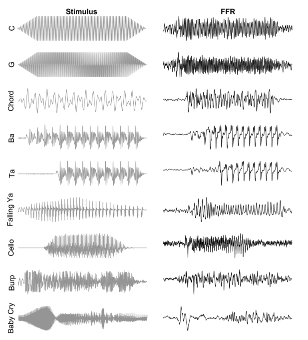 Auditory Neuroscience Lab tweet media