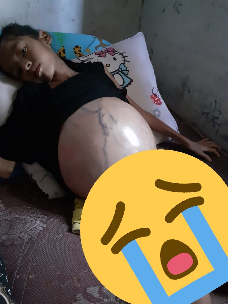 TWITTER PLEASE DO YOUR MAGIC!!

Nama: Sabrina Sanda Amelia
Umur: 11 tahun
Penyakit: Tumor ganas (dibagian Hati)
Alamat: Jl Singalodra Rt 04 RW 01 Kelurahan: Cilacap, Kecamatan: Cilacap Selatan, Kabupaten: CILACAP

No Hp Bapaknya:
Pak Anto: 0856-4006-0693