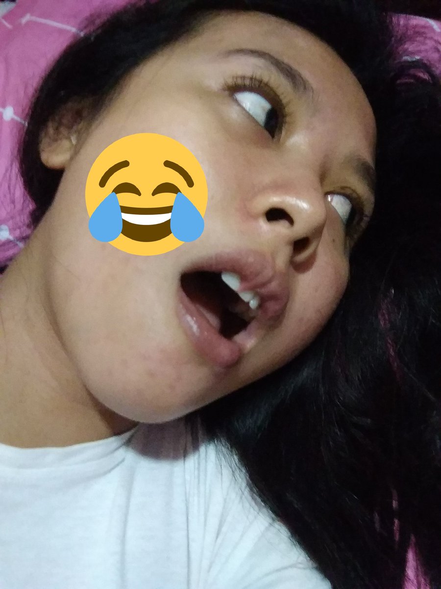 WWinarawati's tweet photo. Bibir kejepit gigi sendiri . Ada yang pernah gini gak ? #ambyar #ambyarkamis #sakit #loroati #cidro #malam #malamjumat #besokharijumat #gilaksih https://t.co/Oxjg6uVao4